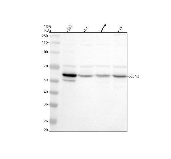 a02558 1 sesn2 primary antibodies wb testing 1