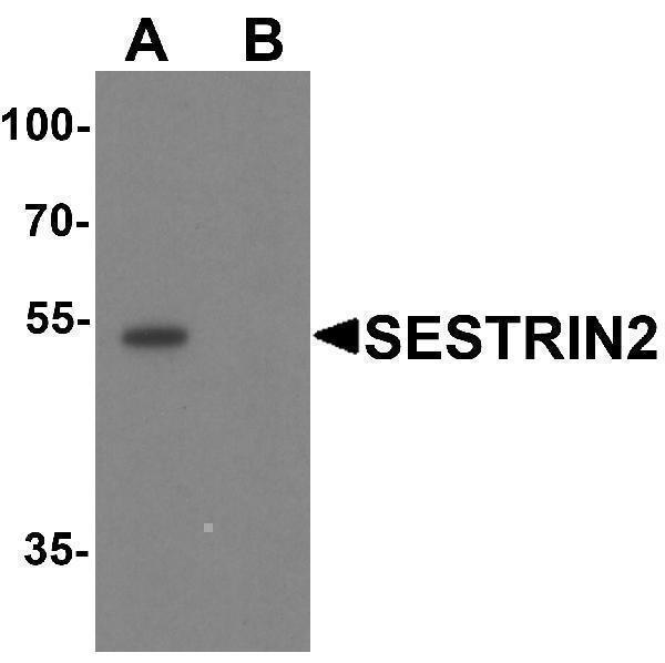 Western blot analysis of SESTRIN2 in mouse kidney tissue lysate with SESTRIN2 antibody at 1 μg/ml in (A) the absence and (B) the presence of blocking peptide