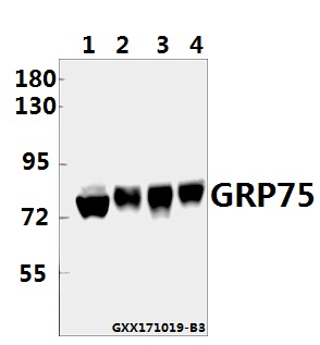 Western blot (WB) analysis of GRP75 (S664) pAb at 1:5000 dilution
Lane1:A549 whole cell lysate(20ug)
Lane2:HepG2K562 whole cell lysate(20ug)
Lane3:The Brain tissue lysate of Mouse(40ug)
Lane4:The Brain tissue lysate of Rat(40ug)