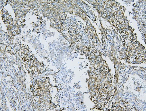 a02562 1 flnb primary antibodies ihc testing 2