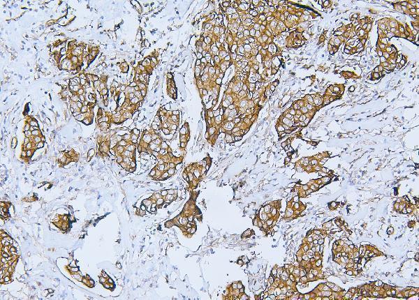a02562 1 flnb primary antibodies ihc testing 3