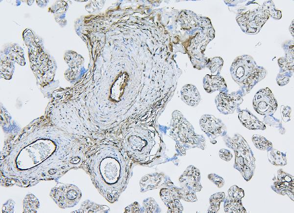 a02562 1 flnb primary antibodies ihc testing 4