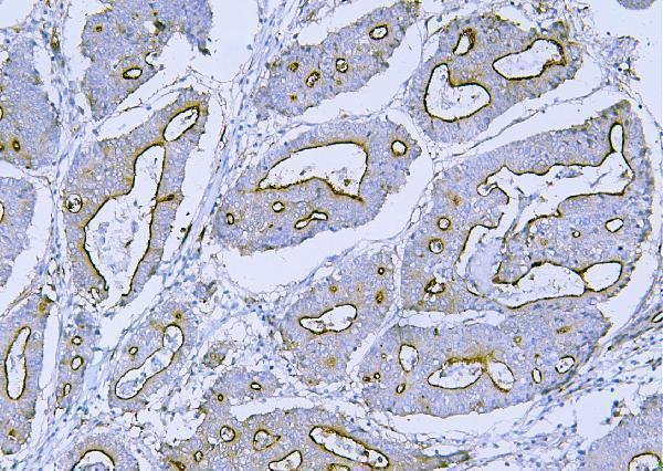 a02562 1 flnb primary antibodies ihc testing 5