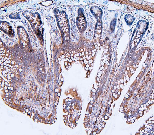 a02562 1 flnb primary antibodies ihc testing 7