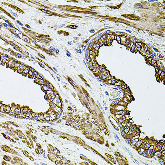 a02562 flnb primary antiboties ihc testing 4