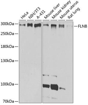 a02562 flnb primary antiboties wb testing 1