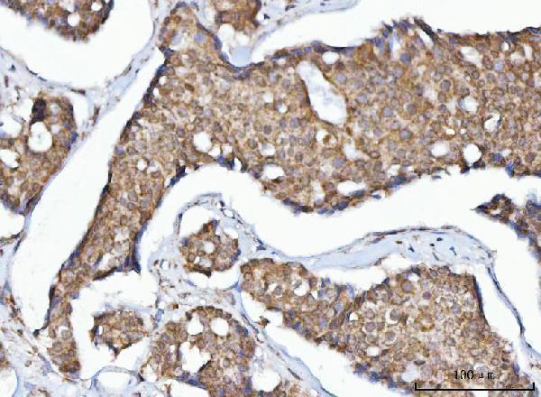  IHC analysis of MFF using anti-MFF antibody (A02563-1)