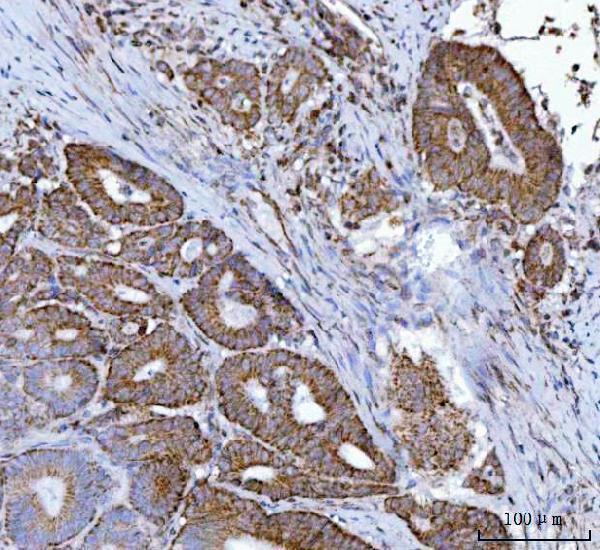 a02563 1 mff primary antibodies ihc testing 4