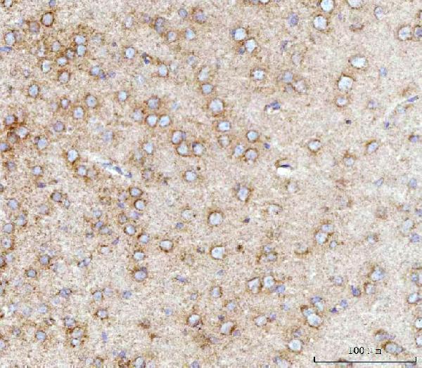 a02563 1 mff primary antibodies ihc testing 5