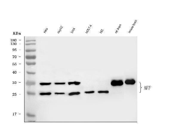  Western blot analysis of MFF using anti-MFF antibody (A02563-1)