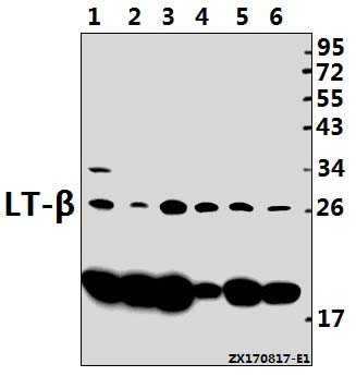 a02565 1 ltb primary antiboties wb testing 1