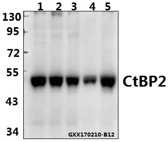 Western blot (WB) analysis of CtBP2 (P432) polyclonal antibody at 1:500 dilution
Lane1:PC3 whole cell lysate(40ug)
Lane2:H1792 whole cell lysate(40ug)
Lane3:Panc1 whole cell lysate(40ug)
Lane4:H9C2 whole cell lysate(40ug)
Lane5:AML-12 whole cell lysate(40ug)