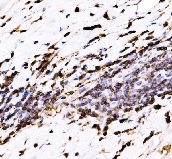  IHC analysis of EVL using anti-EVL antibody (A02568-2)