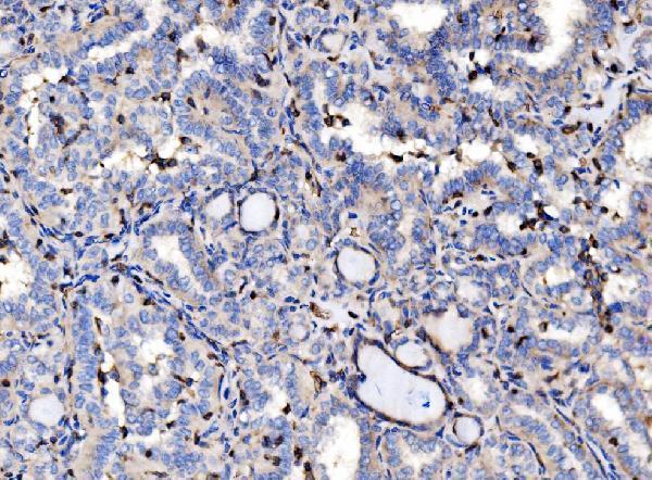  IHC analysis of EVL using anti-EVL antibody (A02568-2)