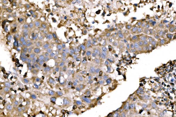 a02568 2 evl primary antibodies ihc testing 4