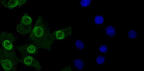 ICC staining MBD3 in A549 cells (green)