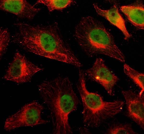 IF analysis of MBD3 using anti-MBD3 antibody (A02571-2) and anti-Beta Tubulin antibody (M01857-3)