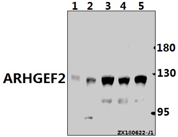 Western blot (WB) analysis of ARHGEF2 (P881) pAb at 1:500 dilution
Lane1:PMVEC whole cell lysate(40ug)
Lane2:AML-12 whole cell lysate(40ug)
Lane3:MCF-7 whole cell lysate(40ug)
Lane4:A549 whole cell lysate(40ug)
Lane5:HuT78 whole cell lysate(20ug)