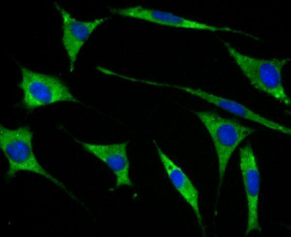 ICC staining GEF H1 in SH-SY-5Y cells (green)