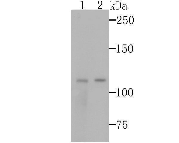 Western blot analysis of GEF H1 on 293T and A431 cells lysates using anti-GEF H1 antibody at 1/500 dilution