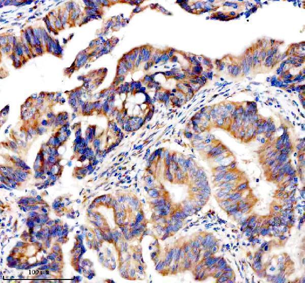  IHC analysis of GEF-H1/ARHGEF2 using anti-GEF-H1/ARHGEF2 antibody (A02572-3)