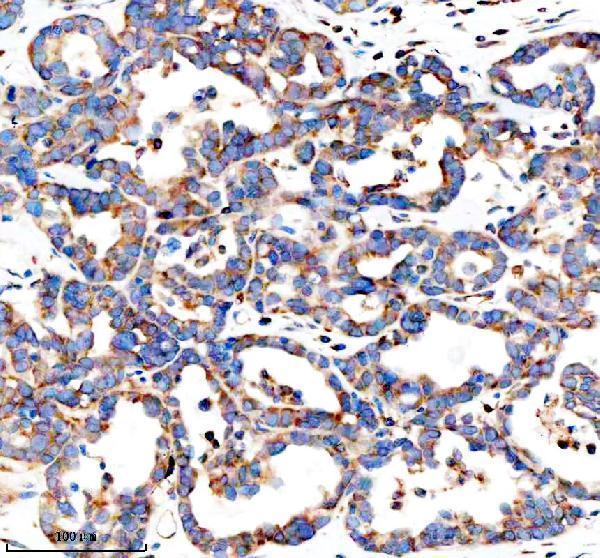  IHC analysis of GEF-H1/ARHGEF2 using anti-GEF-H1/ARHGEF2 antibody (A02572-3)