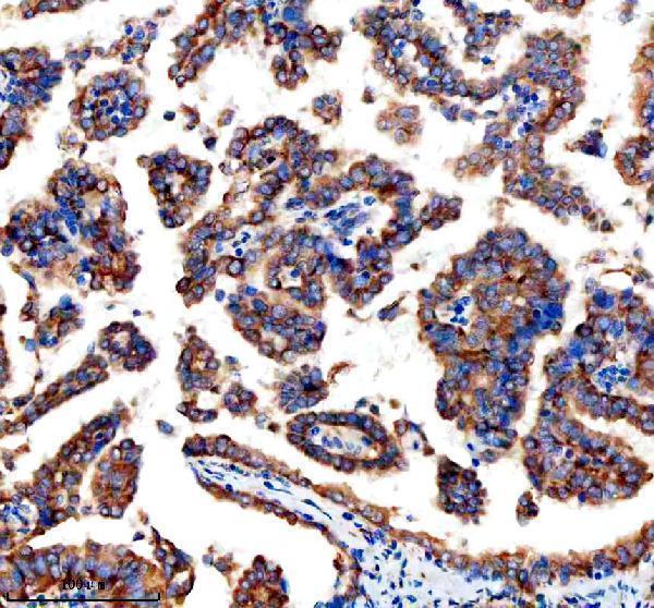 a02572 3 arhgef2 primary antibodies ihc testing 4