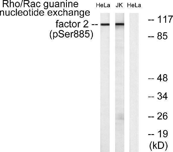 Western blot analysis of lysates from HeLa cells treated with TSA 400nM 24H and Jurkat cells treated with forskolin 40nM 30', using Rho/Rac Guanine Nucleotide Exchange Factor 2 (Phospho-Ser885) Antibody