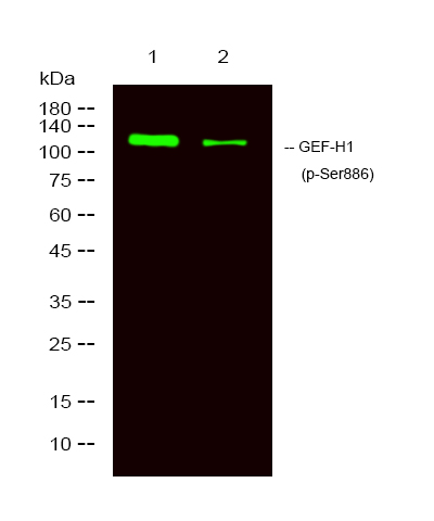 Western Blot analysis of 1 A431 treated with LPS, 2 A431, using primary antibody at 1:1000 dilution