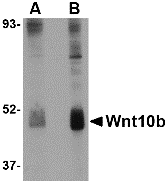 Western blot analysis of Wnt10b in human skeletal muscle tissue lysate with Wnt10b antibody at (A) 2 and (B) 4 μg/mL