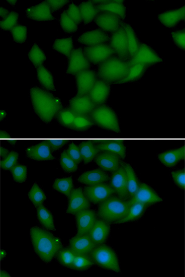 a02576 camk1 primary antiboties if testing 1