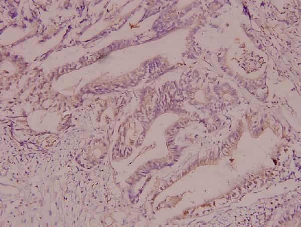 a02576s173 camk1 primary antiboties ihc testing 2