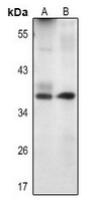 a02577 1 birc7 primary antiboties wb testing 1
