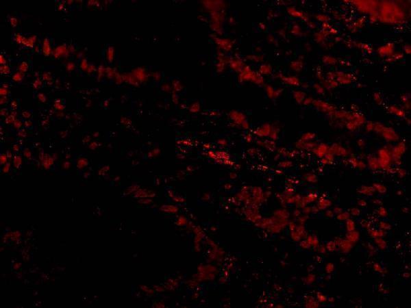 Immunofluorescence of Livin in Human Small Intestine cells with Livin antibody at 20 μg/mL