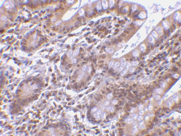 Immunohistochemistry of Livin in human small intestine tissue with Livin antibody at 5 μg/mL