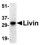 Western blot analysis of Livin expression in human Raji cell lysate with Livin antibody at 0