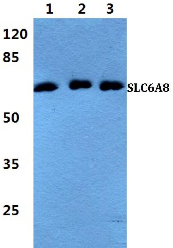 a02579 slc6a8 primary antiboties wb testing 1