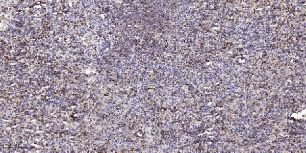 a02584 aspm primary antibodies ihc testing 1