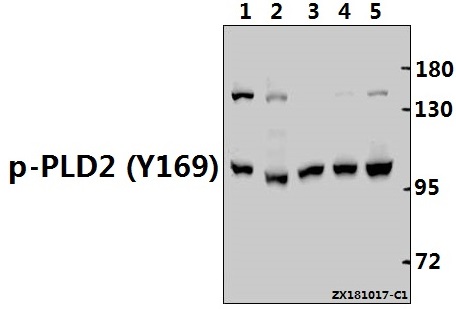 Western blot (WB) analysis of p-PLD2 (Y169) pAb at 1:500 dilution
Lane1:HEK293T whole cell lysate(40ug)
Lane2:C6 whole cell lysate(40ug)
Lane3:The Embryo tissue lysate of Mouse(40ug)
Lane4:A549 whole cell lysate(40ug)
Lane5:Hela whole cell lysate(40ug)
