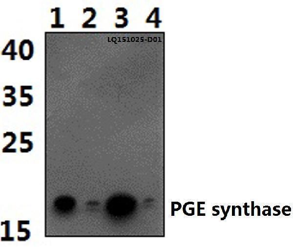 a02587 ptges primary antiboties wb testing 1