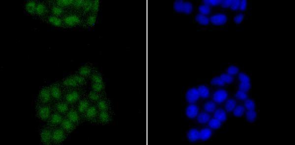 ICC staining SATB2 in PC-12 cells (green)