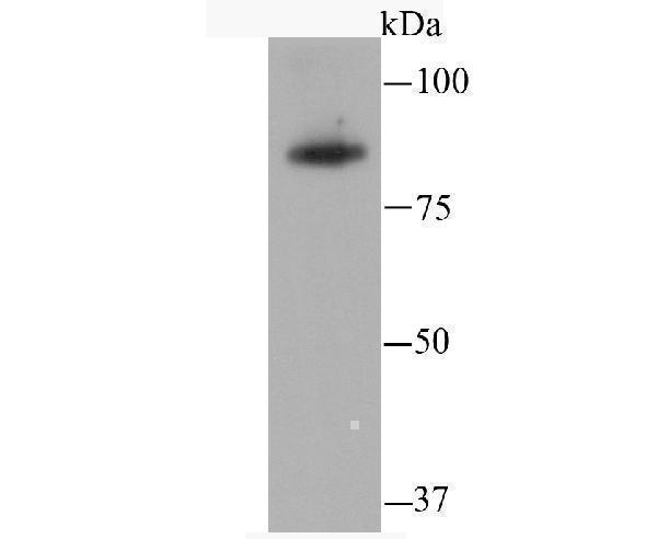 Western blot analysis of SATB2 on THP-1 cell using anti-SATB2 antibody at 1/500 dilution