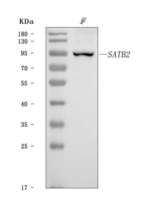 a02588 2 satb2 primary antibodies wb testing 1