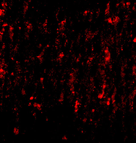 Immunofluorescence of SATB2 in Human Brain cells with SATB2 antibody at 20 μg/mL