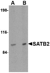 Western blot analysis of SATB2 in mouse brain tissue lysate with SATB2 antibody at (A) 2 and (B) 4 μg/mL