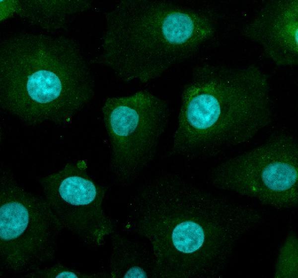 IF analysis of SMG1 using anti-SMG1 antibody (A02589)
