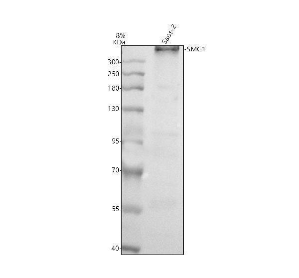 Western blot analysis of SMG1 using anti-SMG1 antibody (A02589)