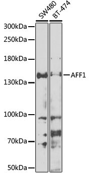 Western blot analysis of extracts of various cell lines, using AFF1 antibody  at 1:1000 dilution