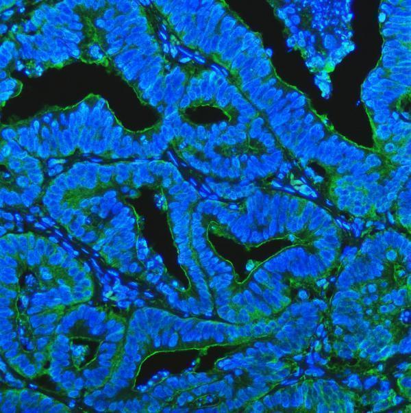 a02591 3 cd13 primary antibodies if testing 5