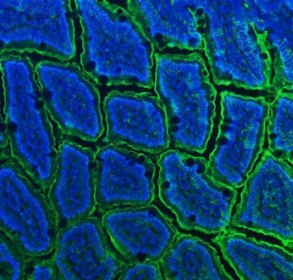a02591 3 cd13 primary antibodies if testing 6